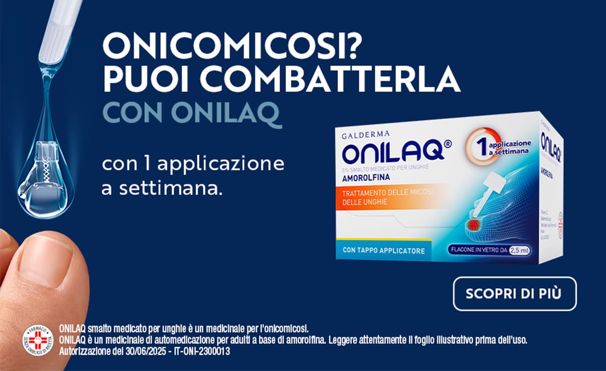 /selezione-onilaq-e-onilaqare