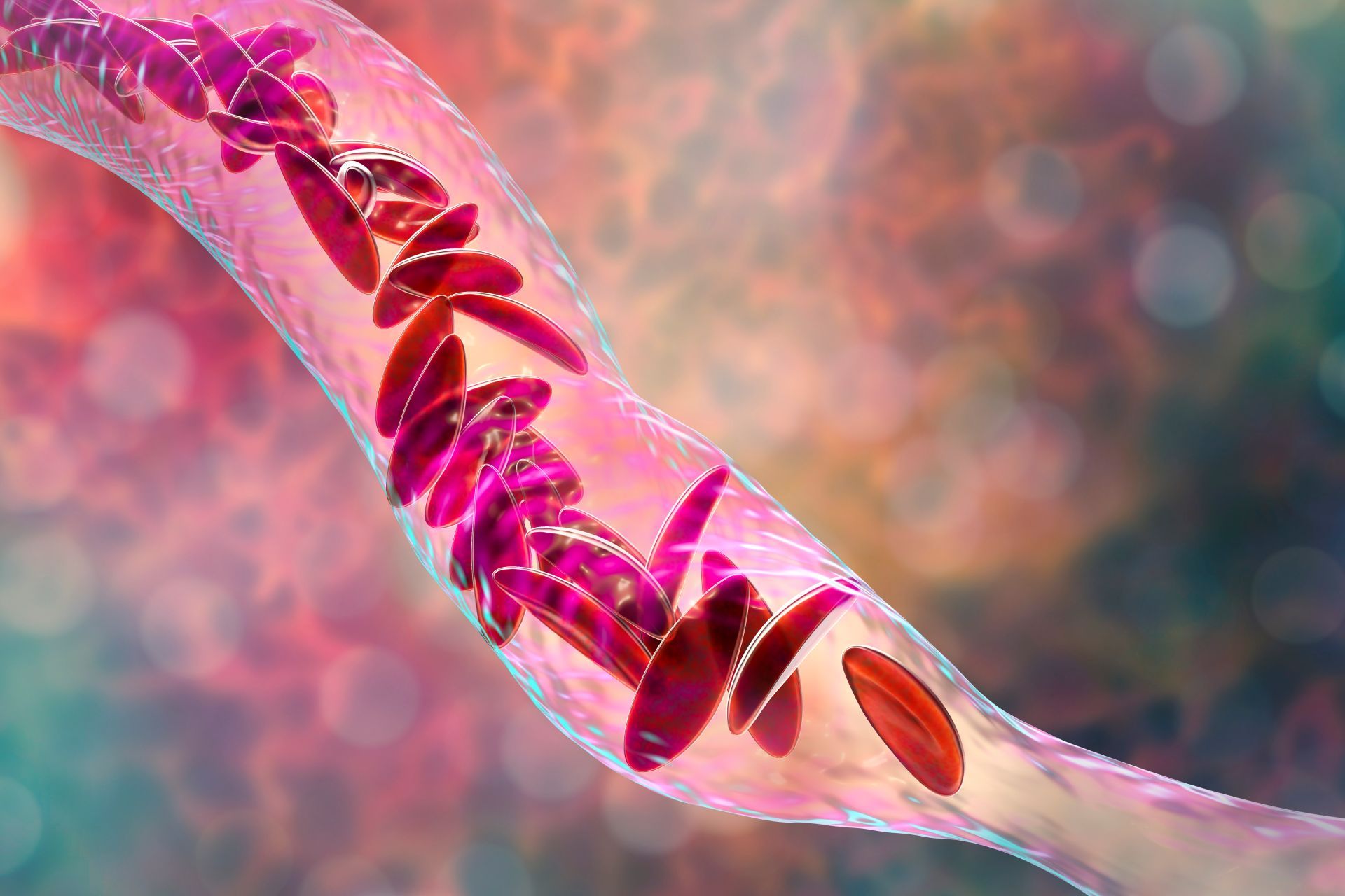 Anemia: come riconoscerla e come curarla