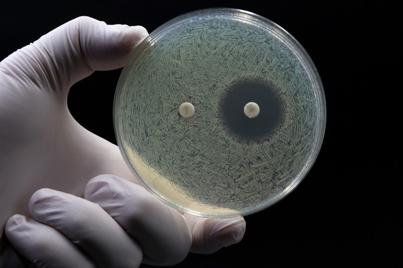 L'amoxicillina e la combinazione con l'acido clavulanico