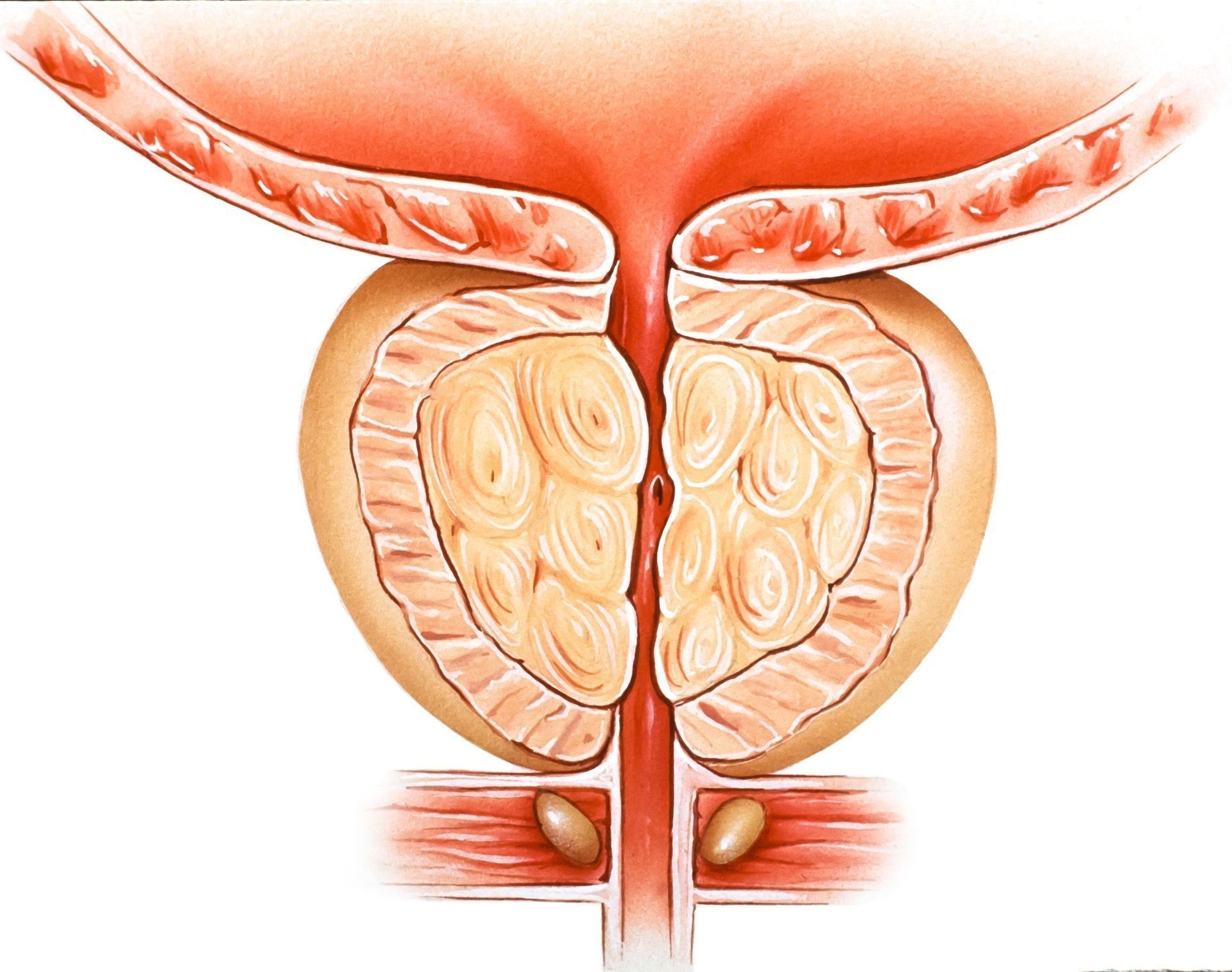 Prostata ingrandita: campanelli d'allarme e trattamenti