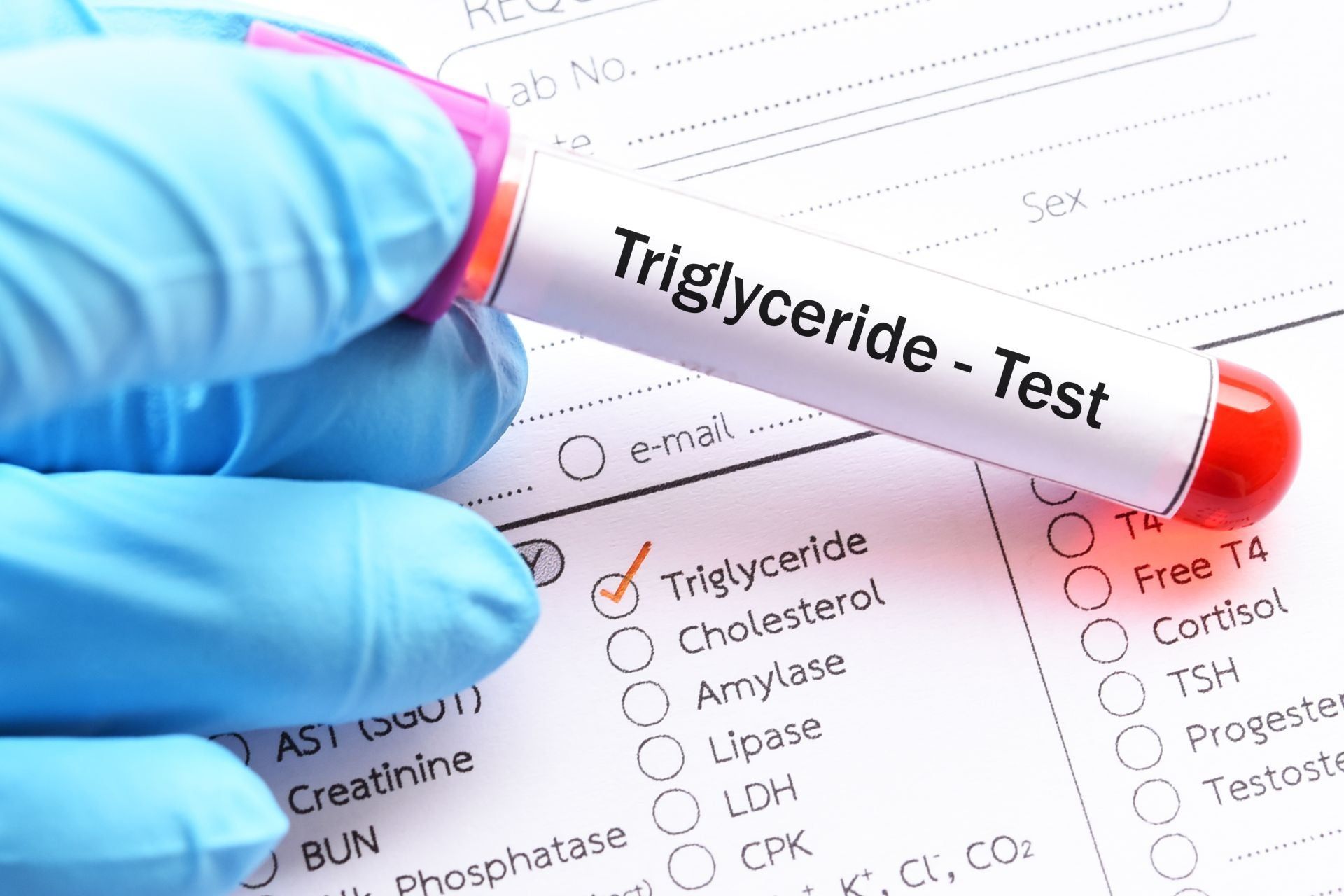 Trigliceridi