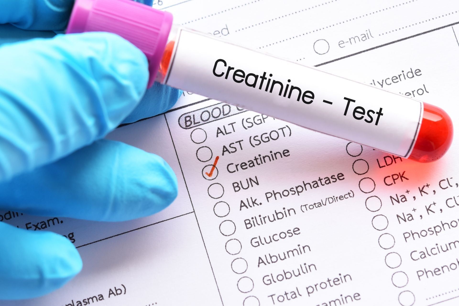 Creatinina: indicatore chiave della funzionalità renale