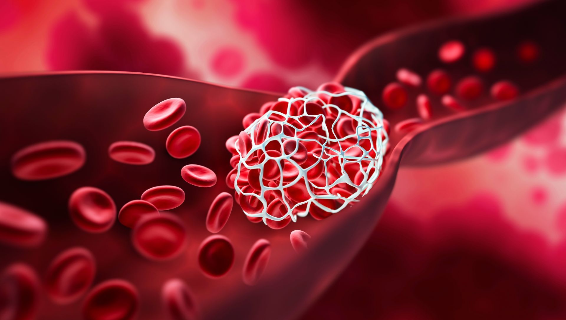 Disturbi della coagulazione del sangue