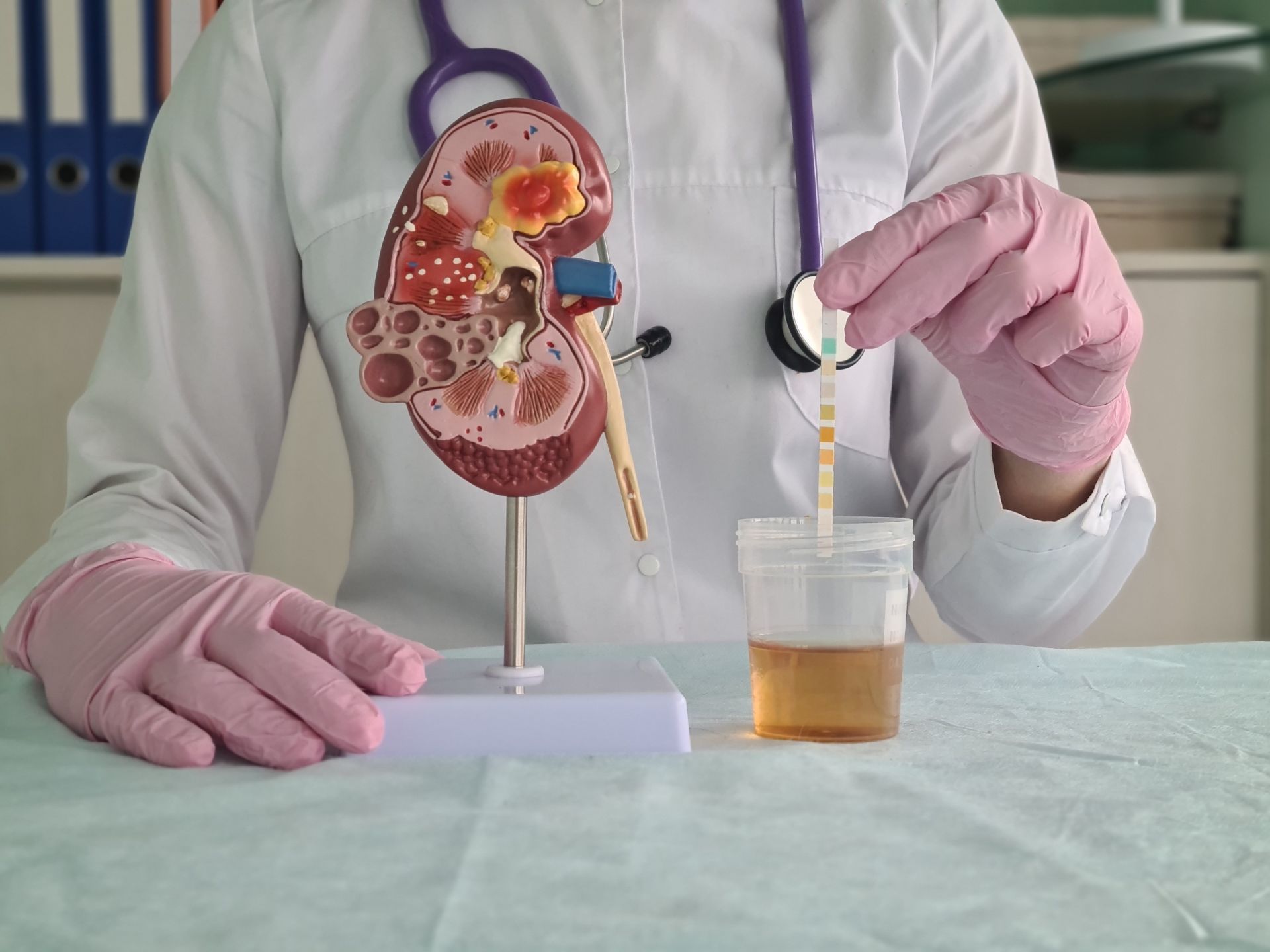 Leucociti nelle urine