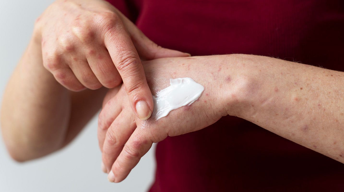 Come trattare le abrasioni della pelle