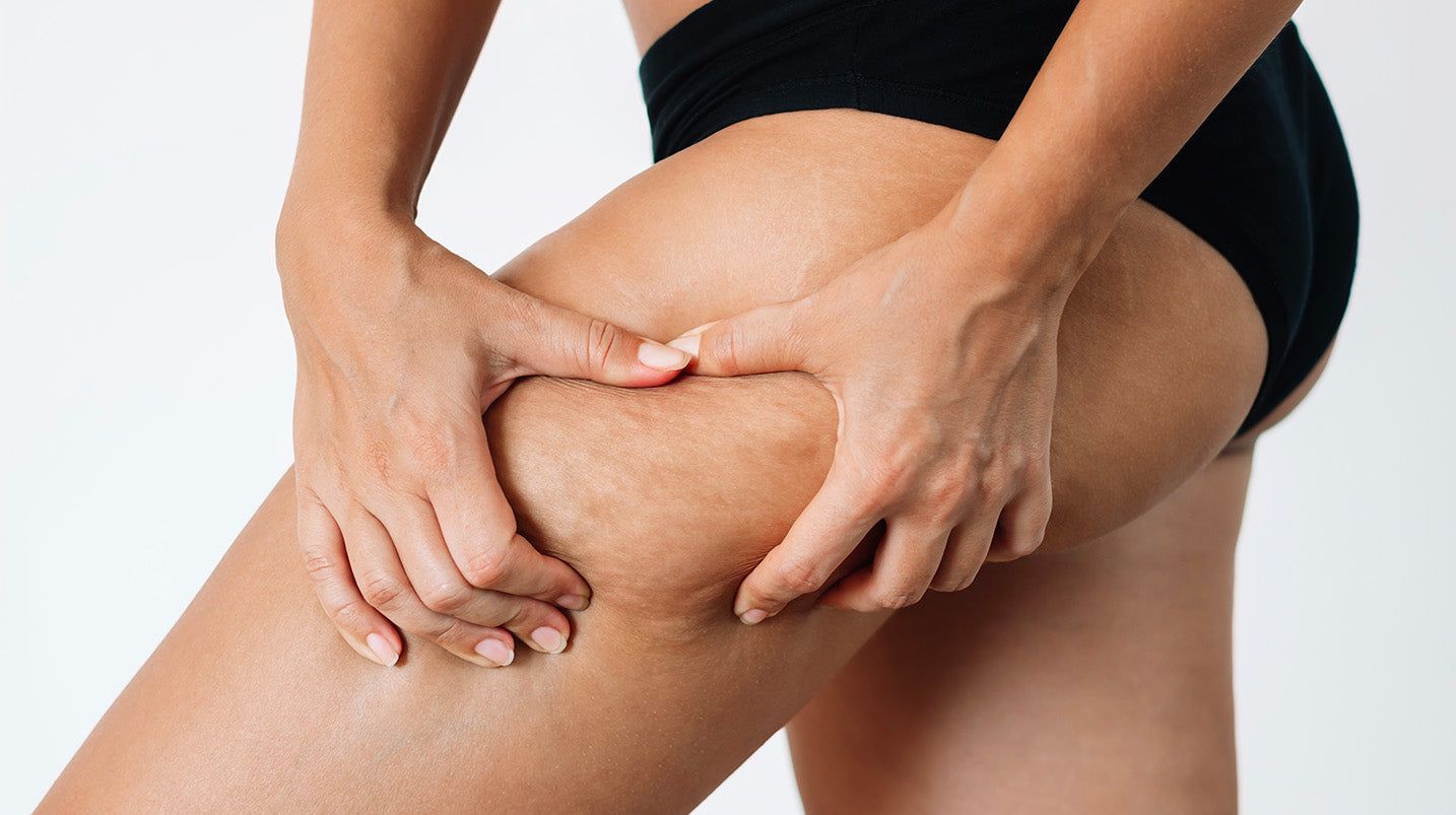 Combattere la cellulite: le 3 migliori creme anticellulite per il 2025 scelte dai nostri farmacisti