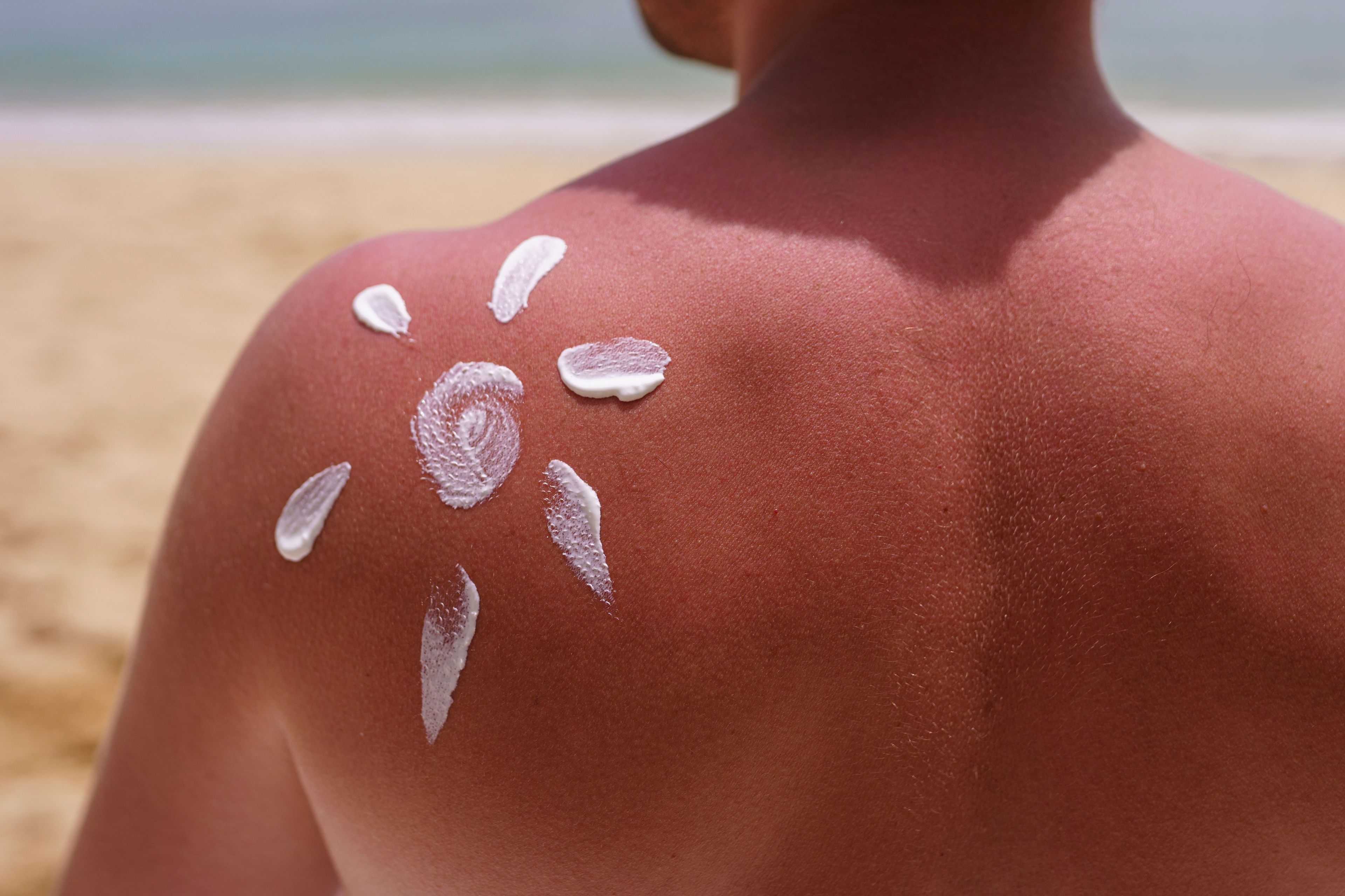Crema solare e abbronzatura: ci si abbronza comunque?
